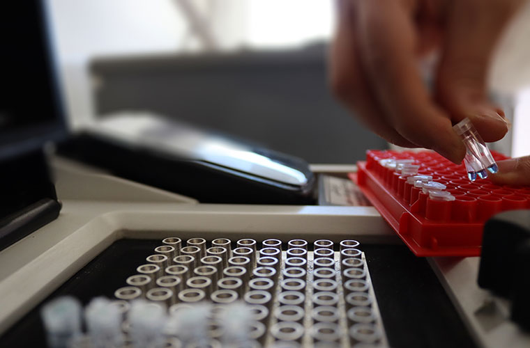 transgenic-tests-event-detection